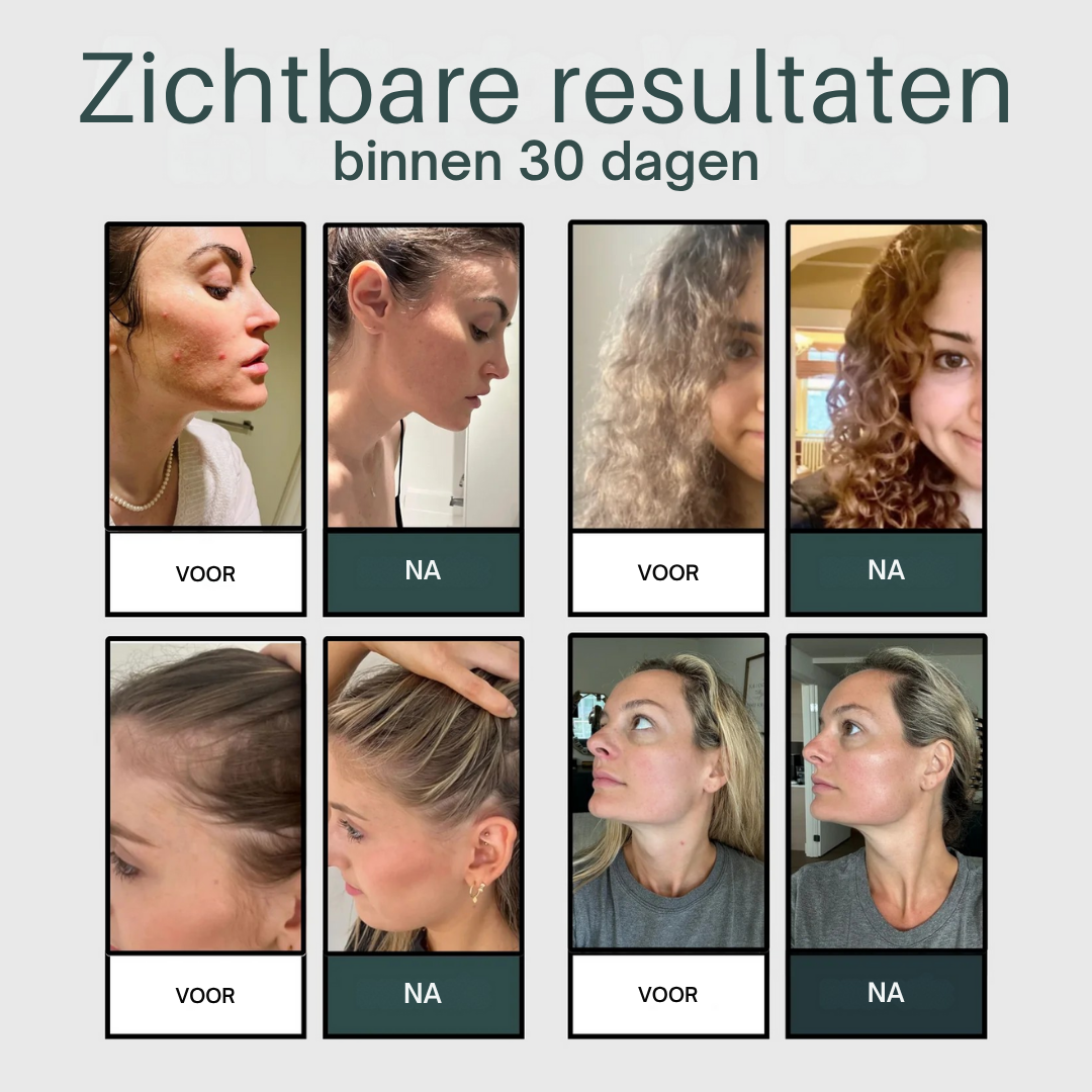 AQUAÉLLE douchekop - Zuiver water, stralende huid, gezond haar | + 5 GRATIS filters