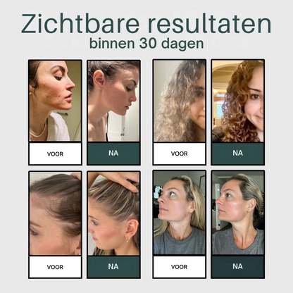 AQUAÉLLE douchekop - Zuiver water, stralende huid, gezond haar | + 5 GRATIS filters